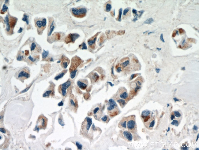 IL17RB Antibody in Immunohistochemistry (Paraffin) (IHC (P))