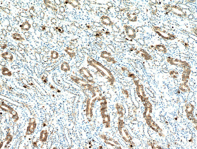 IL17RB Antibody in Immunohistochemistry (Paraffin) (IHC (P))