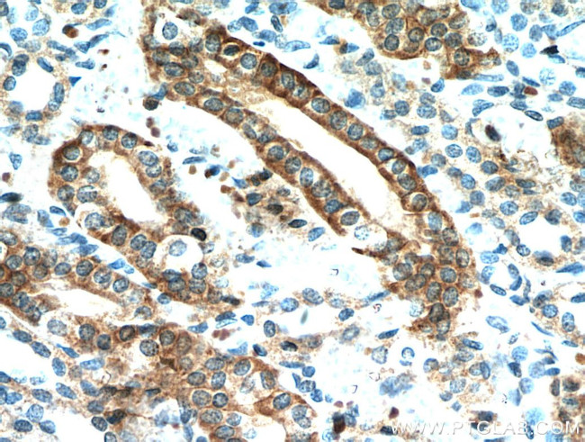 IL17RB Antibody in Immunohistochemistry (Paraffin) (IHC (P))