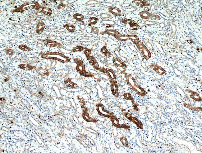 IL17RB Antibody in Immunohistochemistry (Paraffin) (IHC (P))