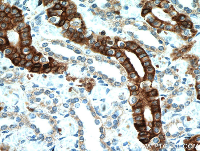 IL17RB Antibody in Immunohistochemistry (Paraffin) (IHC (P))