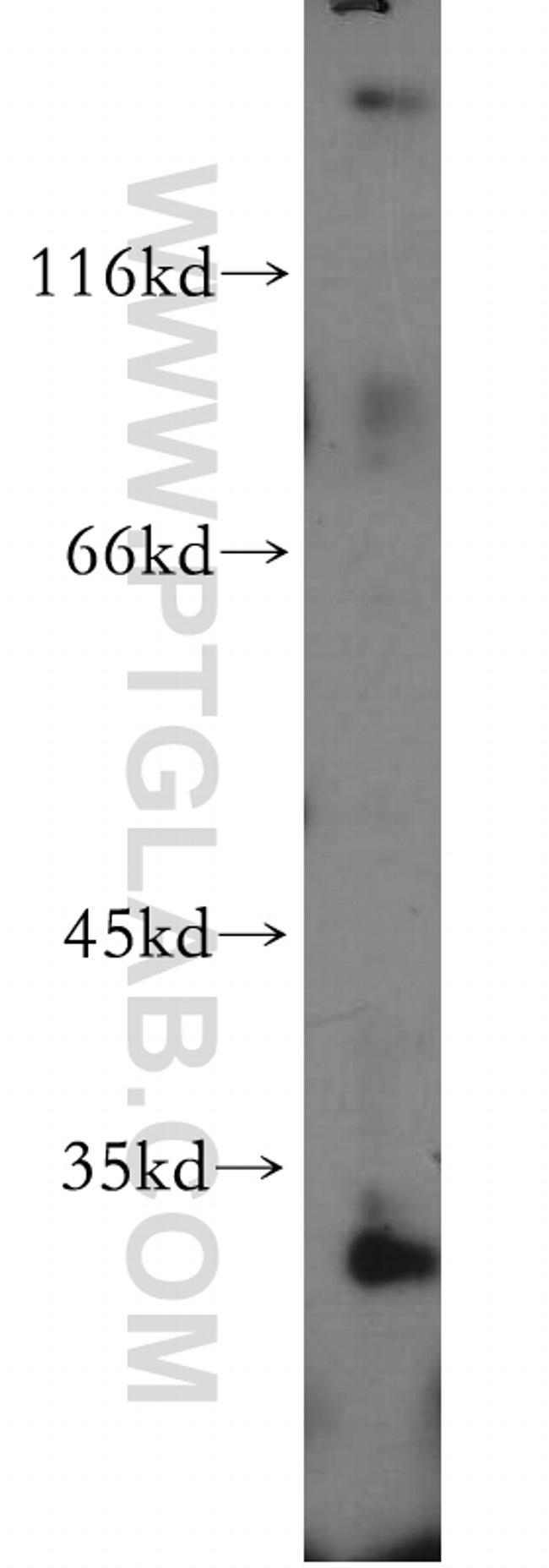 IL17RB Antibody in Western Blot (WB)