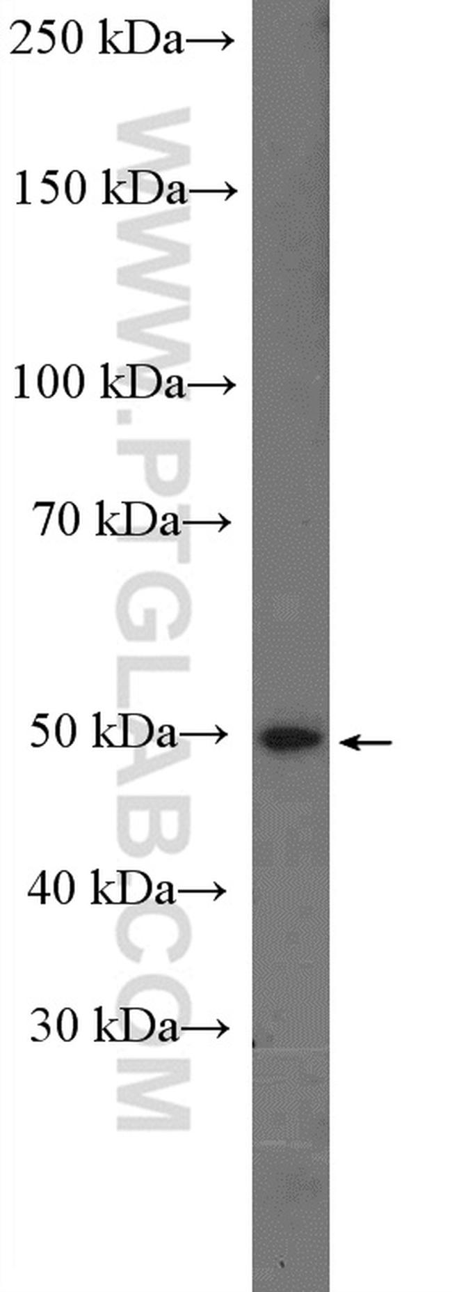 SLC16A2 Antibody in Western Blot (WB)