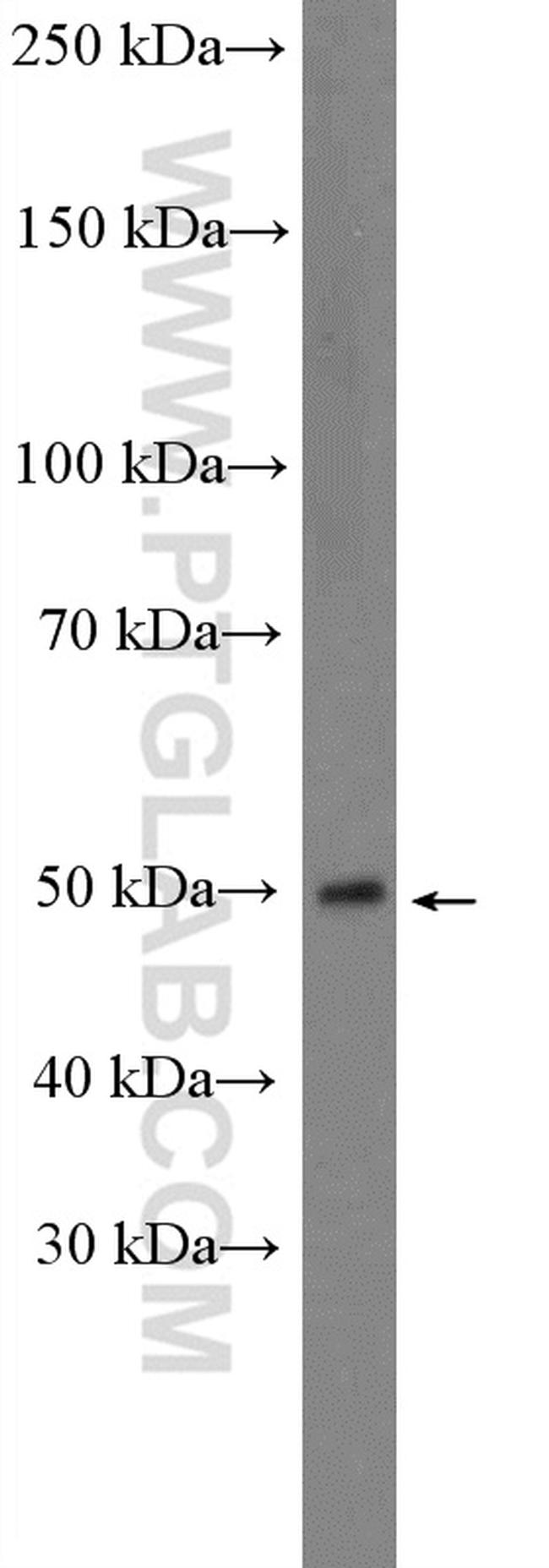 SLC16A2 Antibody in Western Blot (WB)