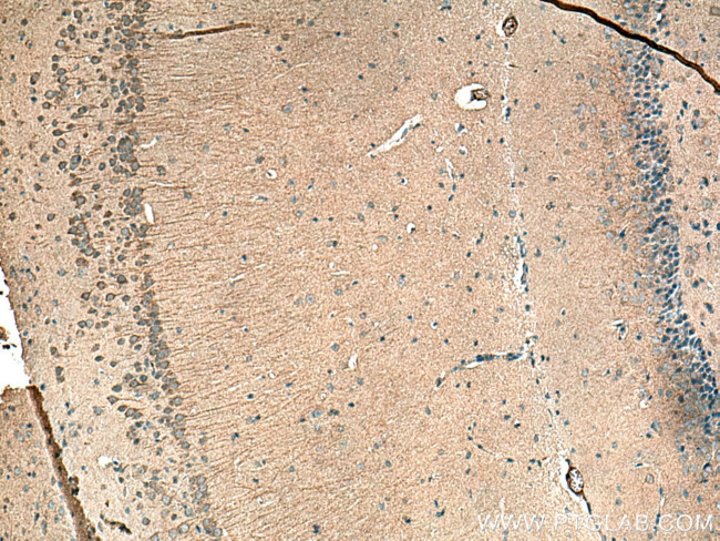 LIS1 Antibody in Immunohistochemistry (Paraffin) (IHC (P))