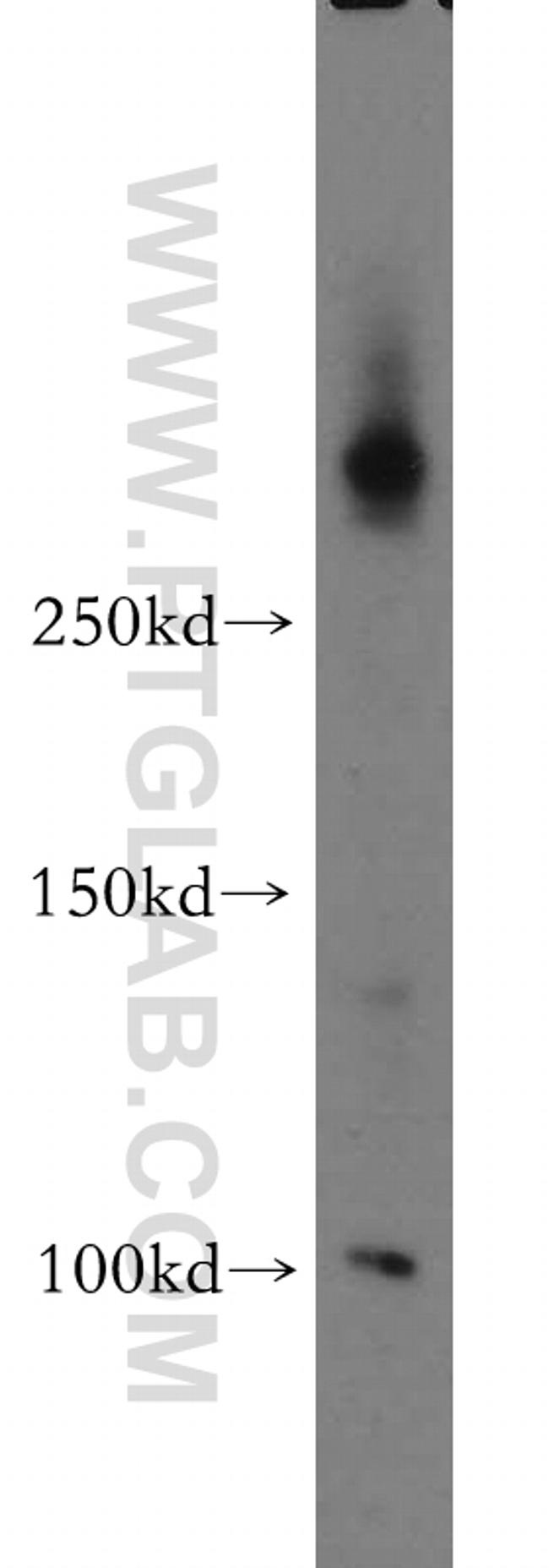 ABCA2 Antibody in Western Blot (WB)