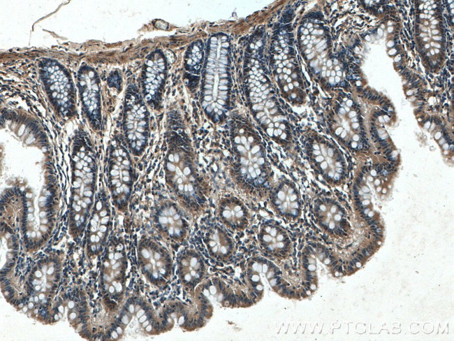 FLNB Antibody in Immunohistochemistry (Paraffin) (IHC (P))