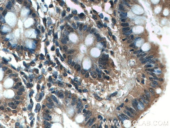 FLNB Antibody in Immunohistochemistry (Paraffin) (IHC (P))