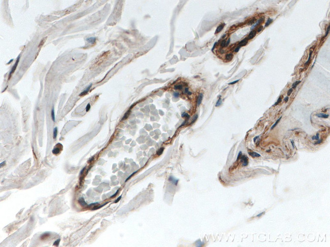 FLNB Antibody in Immunohistochemistry (Paraffin) (IHC (P))