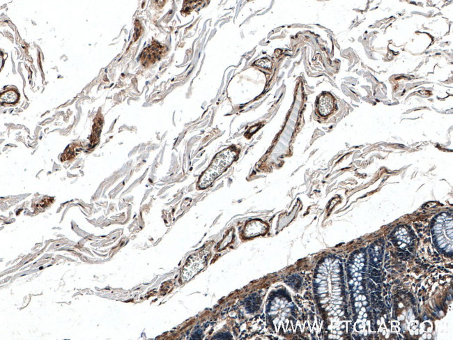 FLNB Antibody in Immunohistochemistry (Paraffin) (IHC (P))