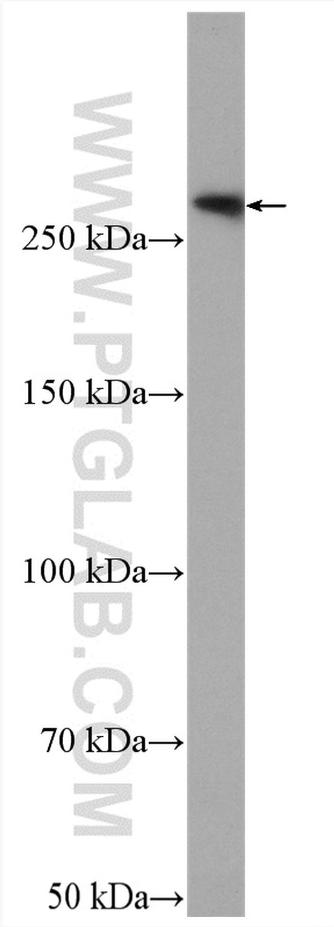 FLNB Antibody in Western Blot (WB)