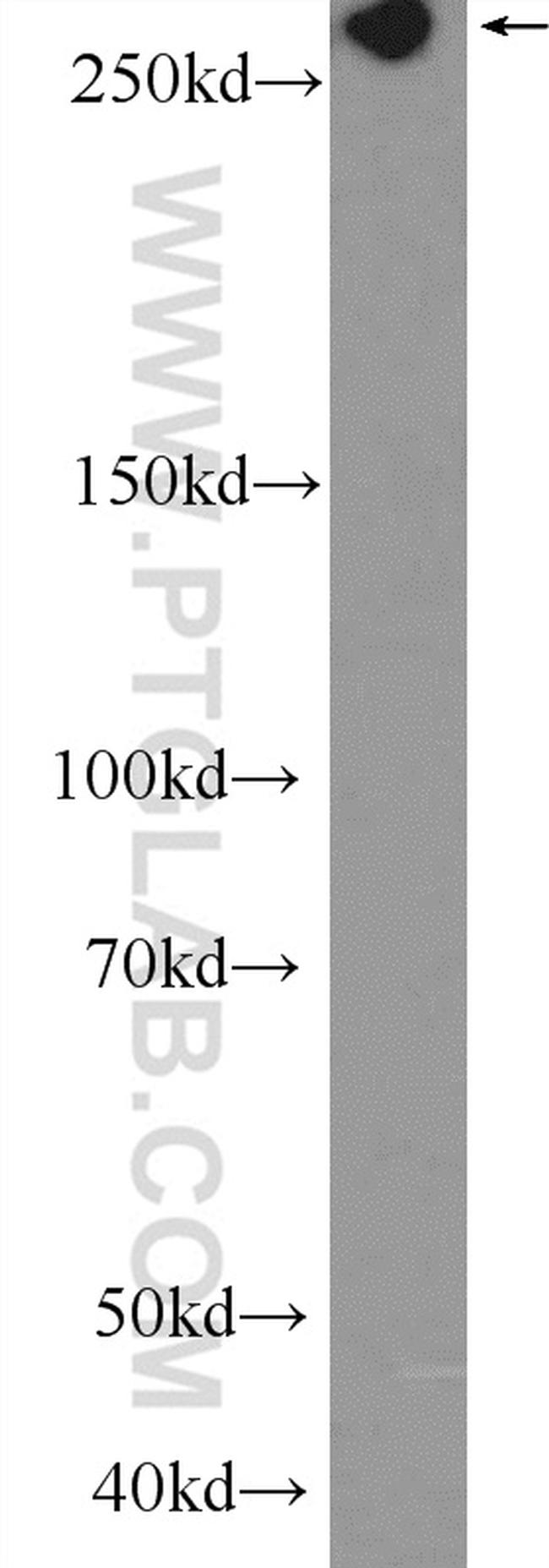 FLNB Antibody in Western Blot (WB)