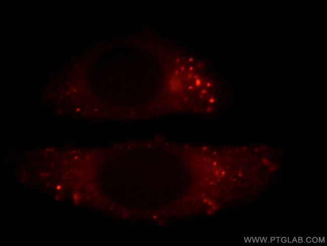 FLNB Antibody in Immunocytochemistry (ICC/IF)