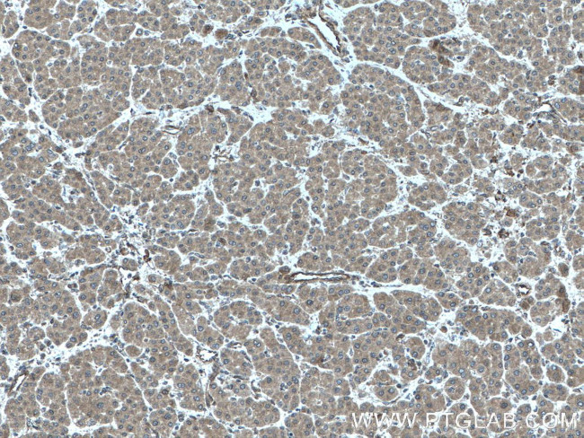 FLNB Antibody in Immunohistochemistry (Paraffin) (IHC (P))