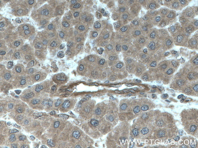 FLNB Antibody in Immunohistochemistry (Paraffin) (IHC (P))