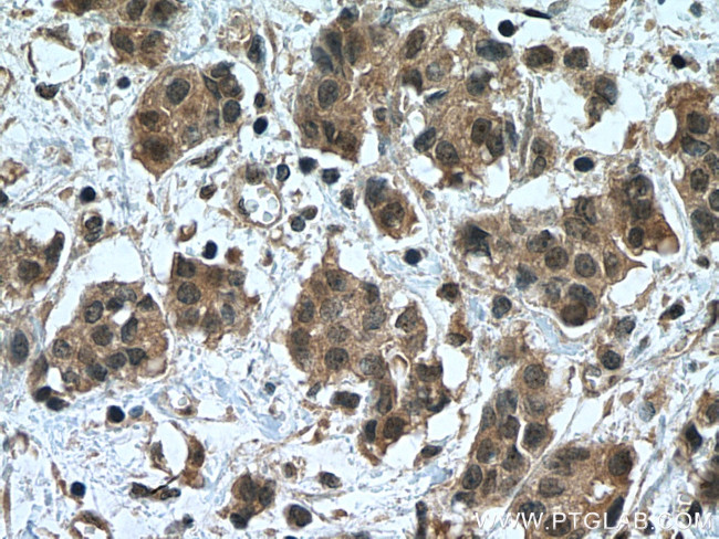 NOTCH1 Antibody in Immunohistochemistry (Paraffin) (IHC (P))