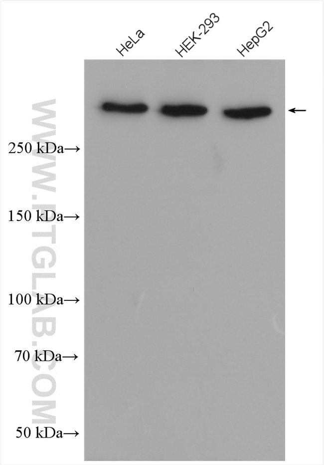 NOTCH1 Antibody in Western Blot (WB)