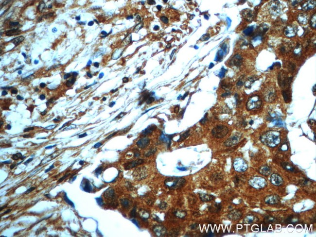 PAWR Antibody in Immunohistochemistry (Paraffin) (IHC (P))