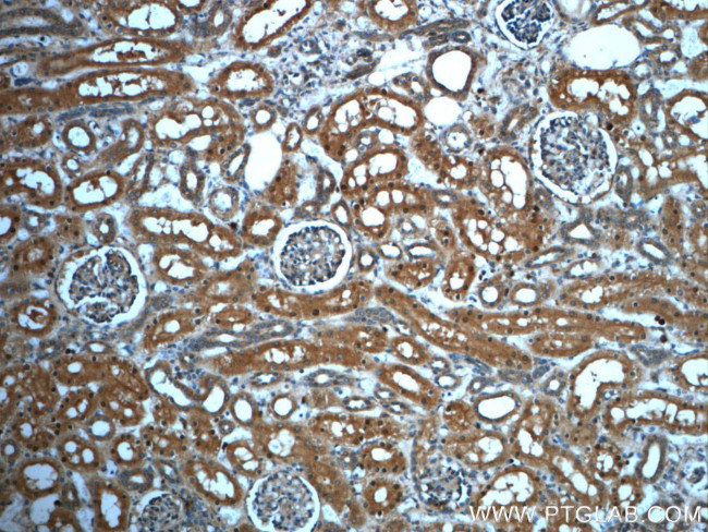 PAWR Antibody in Immunohistochemistry (Paraffin) (IHC (P))