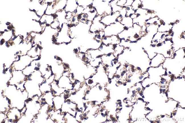 p300 Antibody in Immunohistochemistry (Paraffin) (IHC (P))