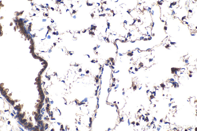 p300 Antibody in Immunohistochemistry (Paraffin) (IHC (P))