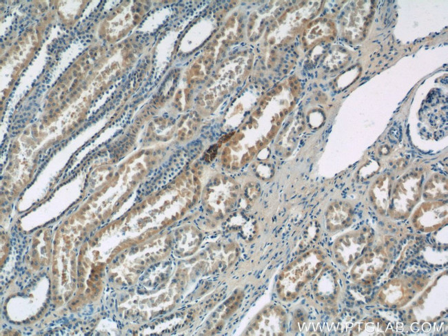 SSTR3 Antibody in Immunohistochemistry (Paraffin) (IHC (P))