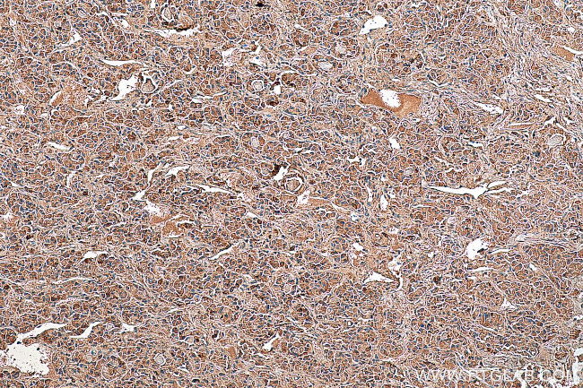 SSTR3 Antibody in Immunohistochemistry (Paraffin) (IHC (P))