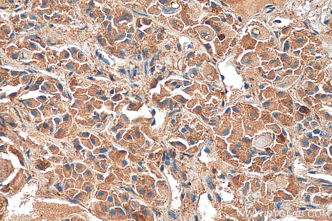 SSTR3 Antibody in Immunohistochemistry (Paraffin) (IHC (P))