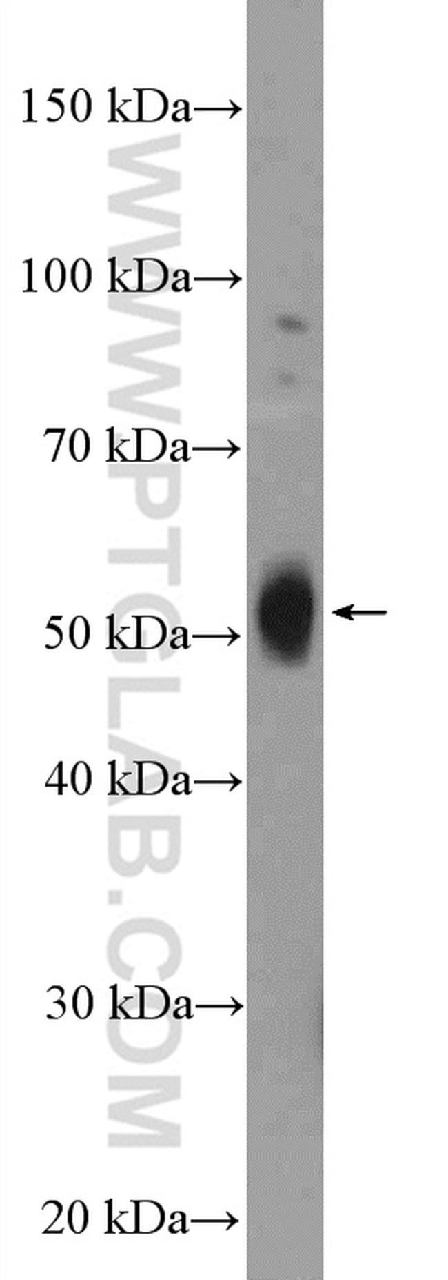 SSTR3 Antibody in Western Blot (WB)