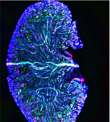 SHH Antibody in Immunocytochemistry (ICC/IF)