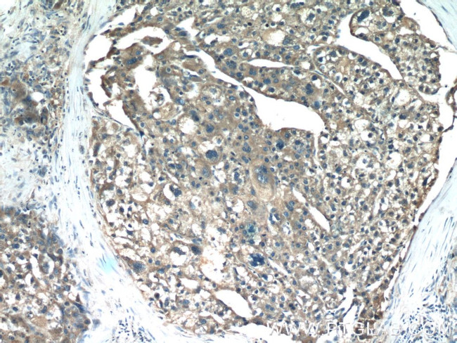 SHH Antibody in Immunohistochemistry (Paraffin) (IHC (P))