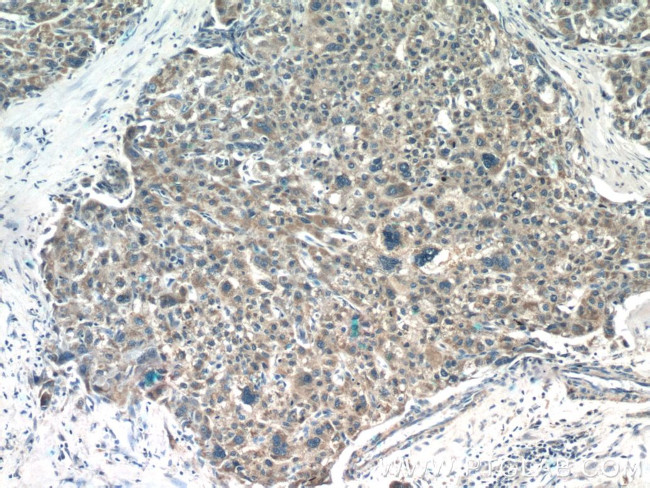 SHH Antibody in Immunohistochemistry (Paraffin) (IHC (P))