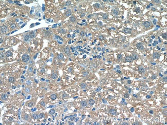 SHH Antibody in Immunohistochemistry (Paraffin) (IHC (P))