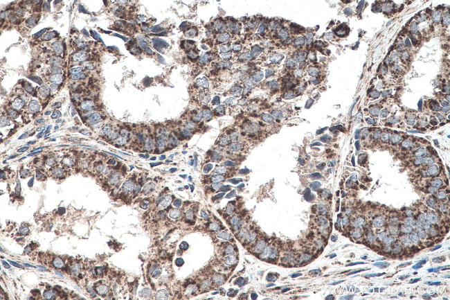 SHH Antibody in Immunohistochemistry (Paraffin) (IHC (P))