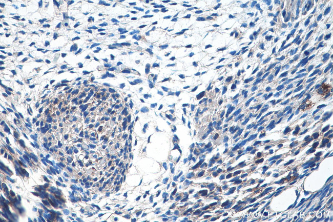 SHH Antibody in Immunohistochemistry (Paraffin) (IHC (P))