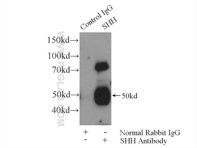 SHH Antibody in Immunoprecipitation (IP)