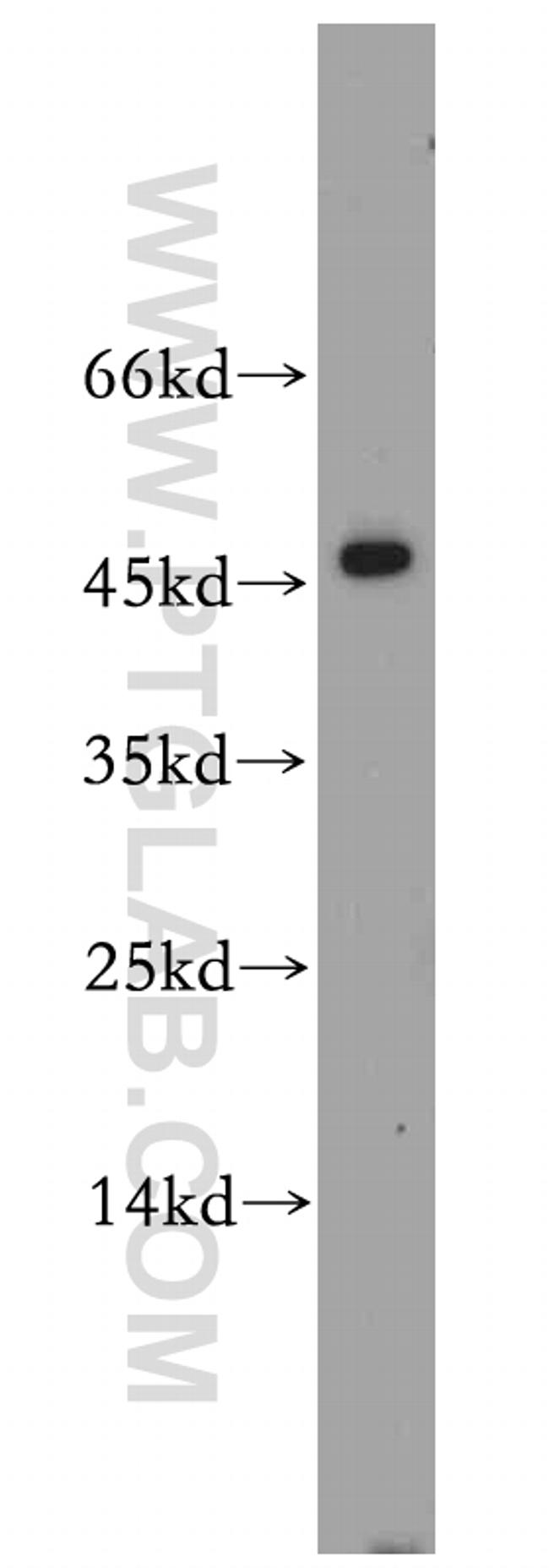 SHH Antibody in Western Blot (WB)