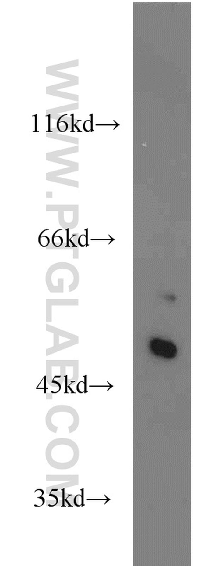 SHH Antibody in Western Blot (WB)