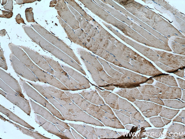 IRS2 Antibody in Immunohistochemistry (Paraffin) (IHC (P))