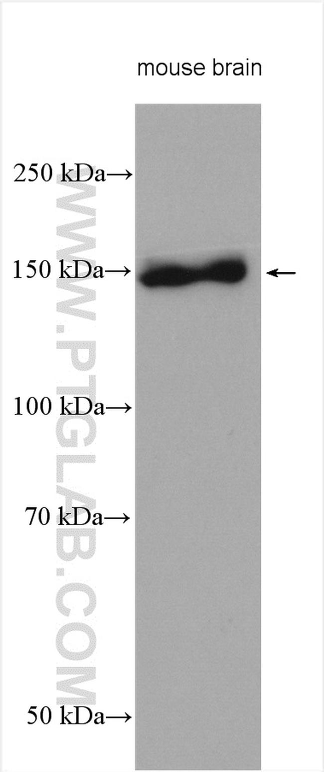 IRS2 Antibody in Western Blot (WB)