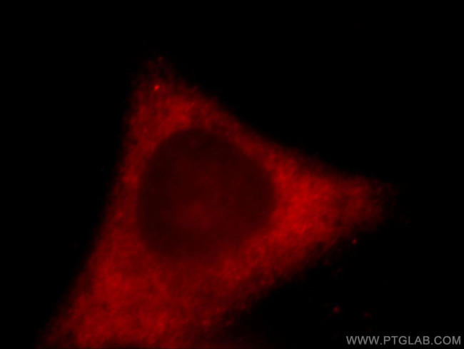 ACSL3 Antibody in Immunocytochemistry (ICC/IF)