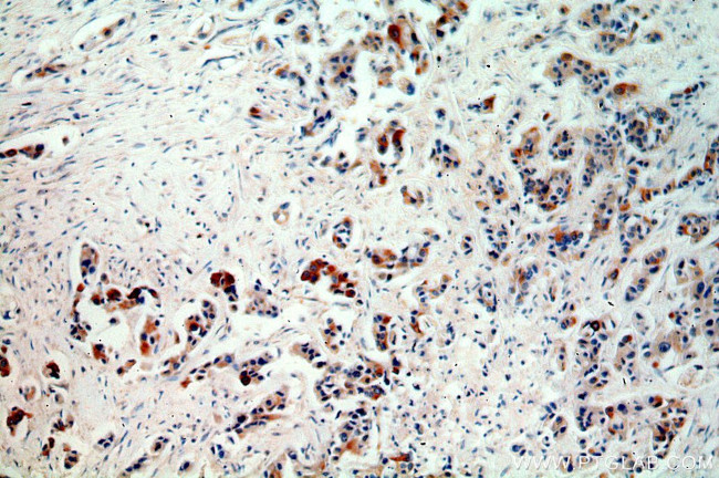 FGF8 Antibody in Immunohistochemistry (Paraffin) (IHC (P))