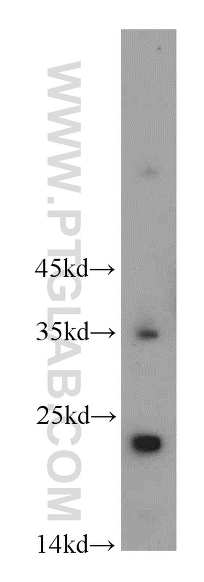 FGF8 Antibody in Western Blot (WB)