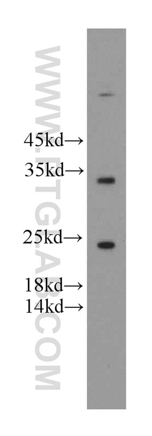 FGF8 Antibody in Western Blot (WB)