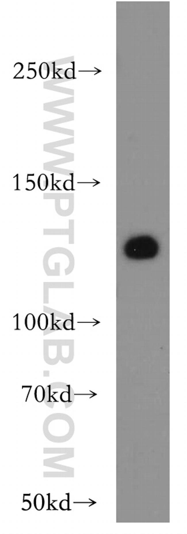 VEGFR3 Antibody in Western Blot (WB)