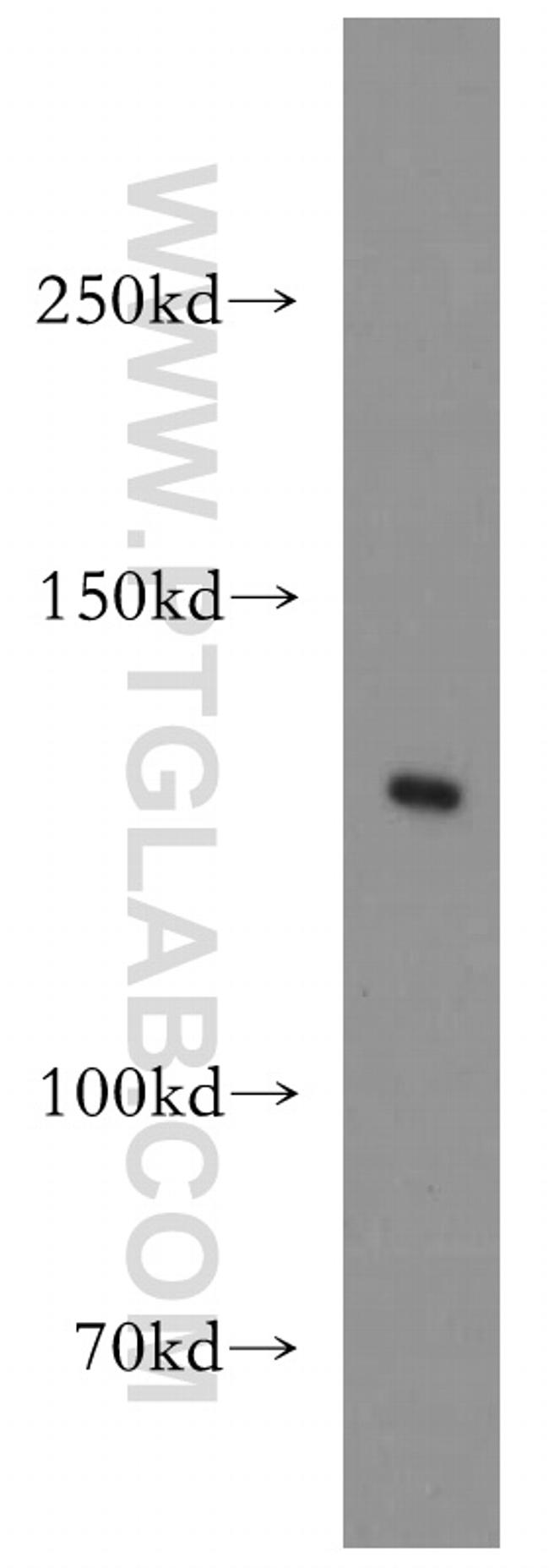 VEGFR3 Antibody in Western Blot (WB)