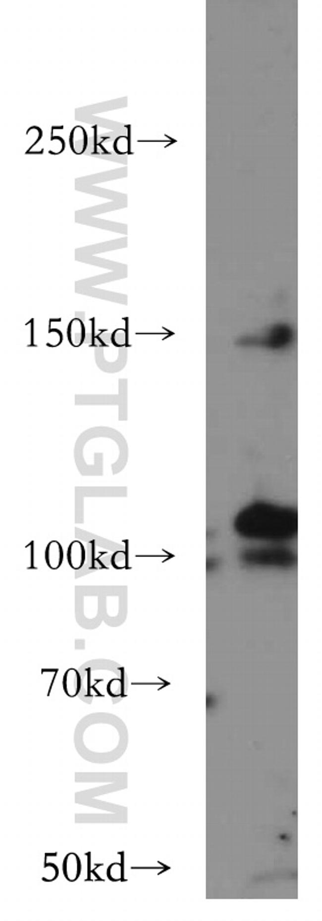 VEGFR3 Antibody in Western Blot (WB)