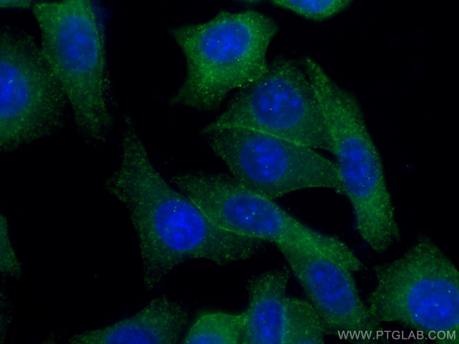 GHR Antibody in Immunocytochemistry (ICC/IF)