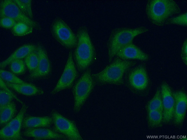 GHR Antibody in Immunocytochemistry (ICC/IF)