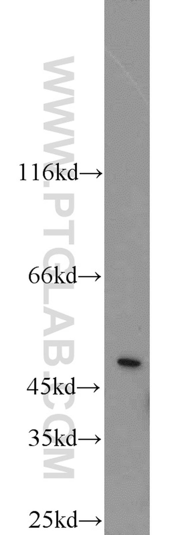 GHRHR Antibody in Western Blot (WB)